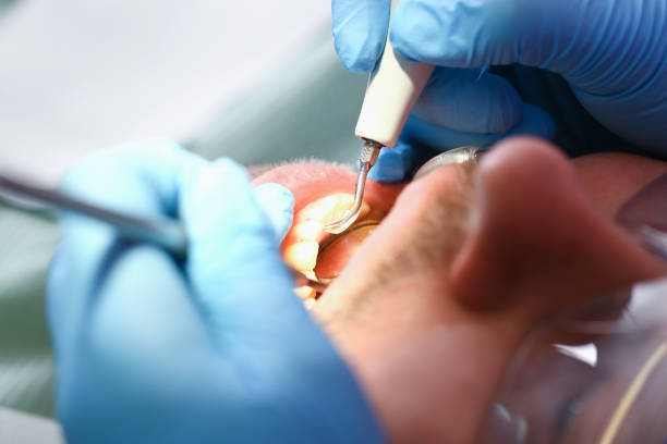 Emergency Dentist for Kids in OH